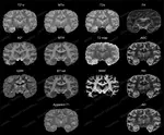 Multiple MRI Contrasts Matters