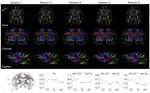 Multi-contrast MR imaging of awake macaque monkeys