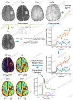 Dynamic Contrast-Enhanced MRI (DCE-MRI) Data Analysis Toolbox