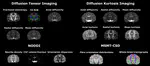 Diffusion-MRI