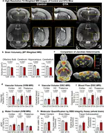 Inducing sterile pyramidal neuronal death in mice to model distinct aspects of gray matter encephalitis