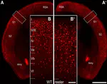 Increased Callosal Connectivity in Reeler Mice Revealed by Brain-Wide Input Mapping of VIP Neurons in Barrel Cortex