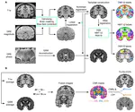 Fusion of quantitative susceptibility maps and T1-weighted images improve brain tissue contrast in primates